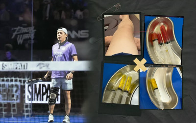 Unggahan Ariel NOAH Soal Cedera Meniscus Viral: Aktivitas Padelnya Jadi Sorotan