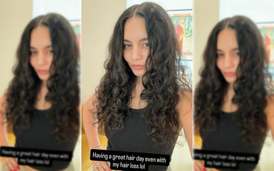 Vanessa Hudgens Spill Realita Usai Melahirkan, Rambut Rontok Jadi Sorotan