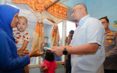 Legislator Gerindra Salurkan Bantuan untuk Balita Pengidap Tumor di Padang